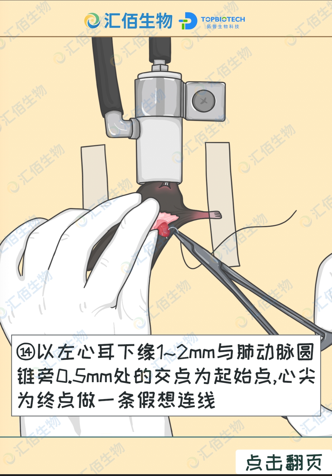 14步骤十四;以左心耳右缘与肺动脉的交点为 起始点，心尖为终点做一条假想连 线.jpg